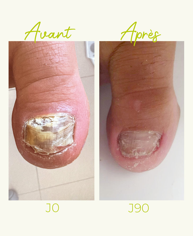 alvadiem-soins-des-ongles-ongles-jaunis-soin-ongles-propolis-10-ml image 4