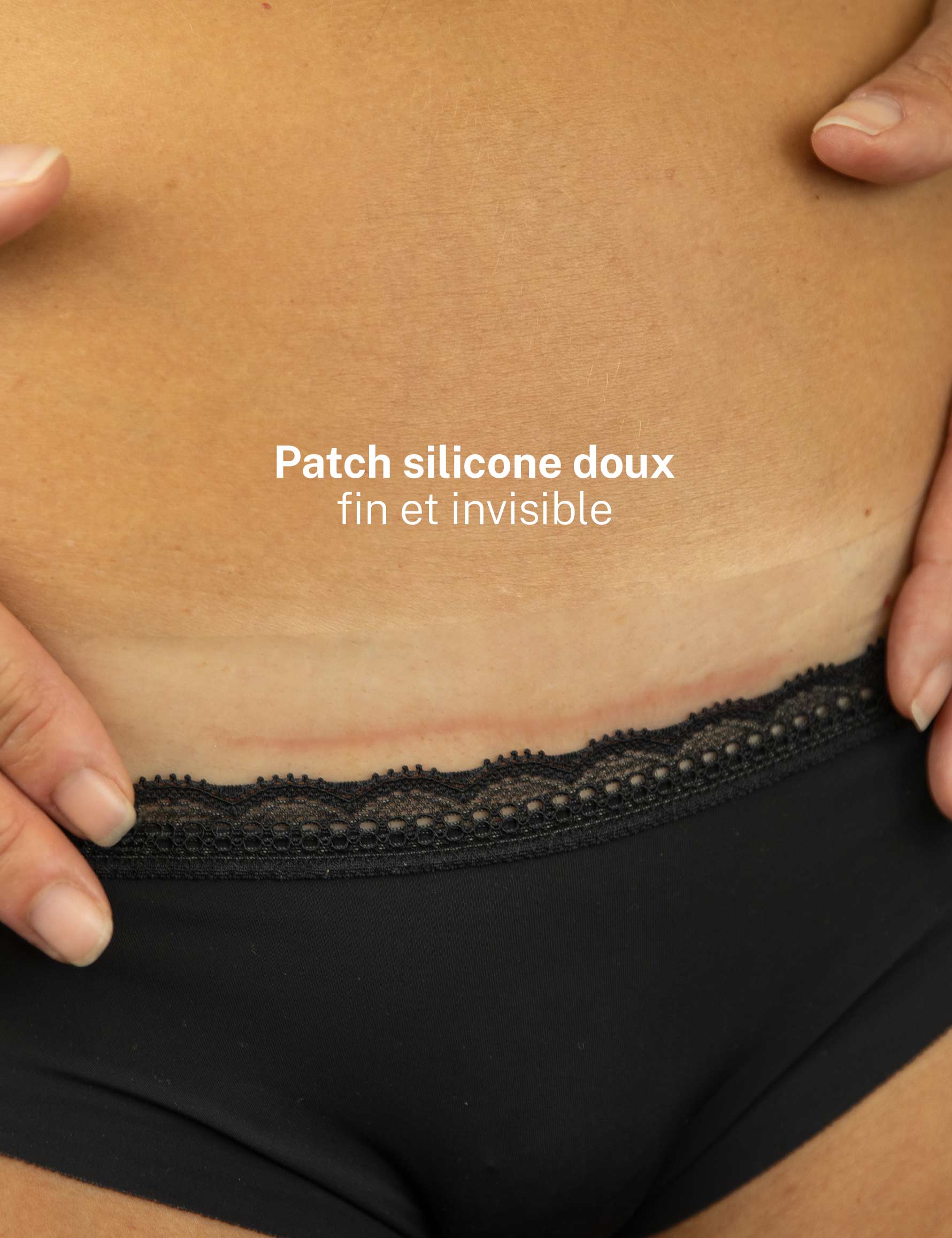 alvadiem-melicare-patch-silicone-cicatrice-c-sarienne image 4