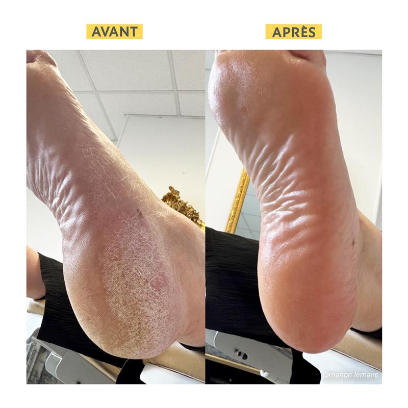 alvadiem-soins-du-corps-onguent-r-parateur-fissures-irritations image 7