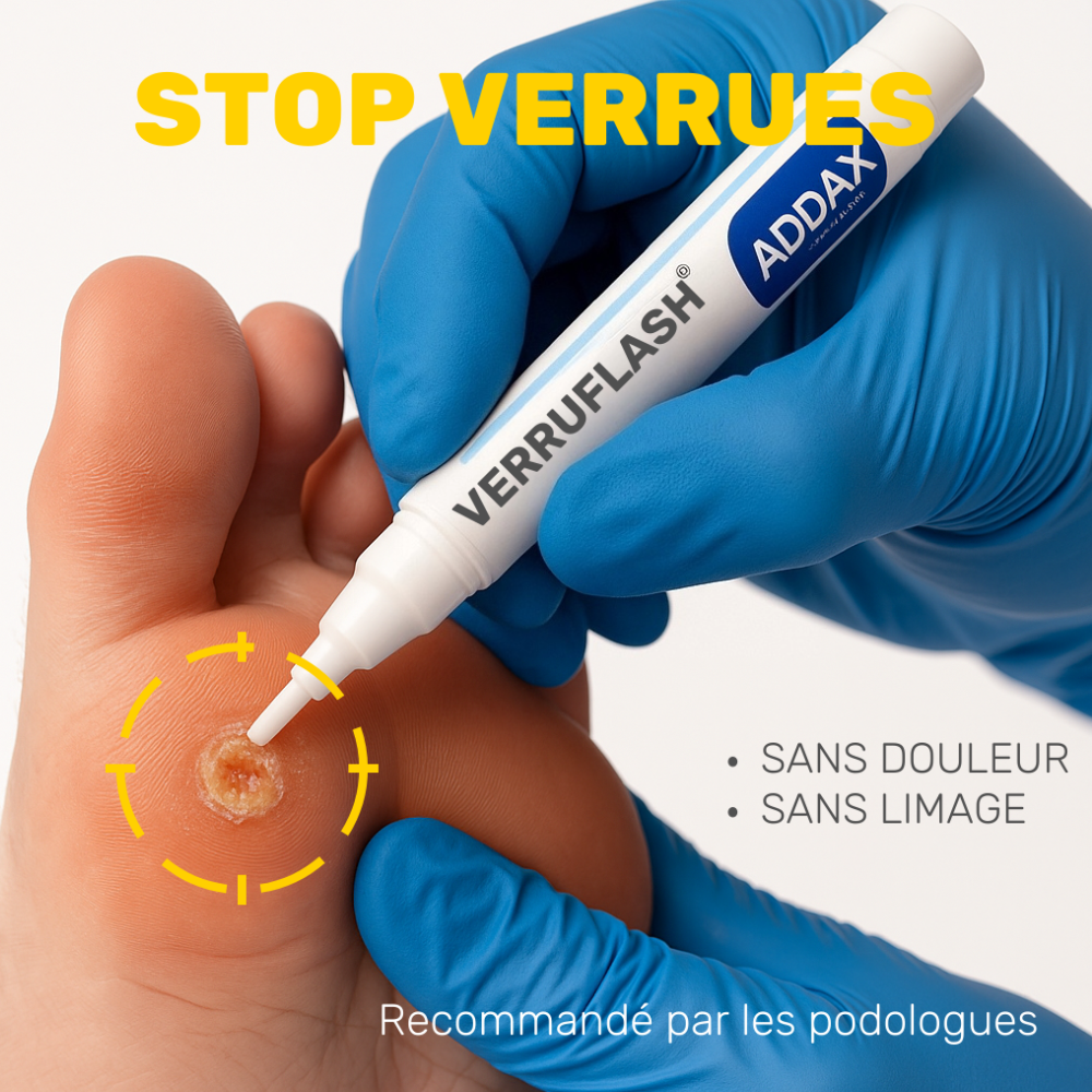 addax-verruflash-pro-stylo-verrues-mains-pieds-corps-acide-formique image 2