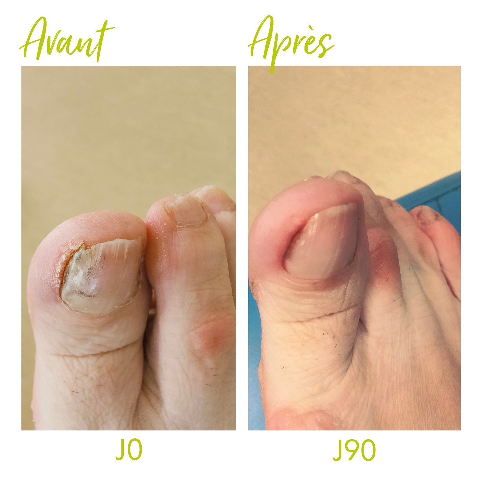 alvadiem-soins-des-ongles-ongles-jaunis-soin-ongles-propolis-10-ml image 3