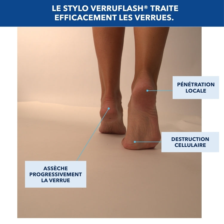 addax-verruflash-pro-stylo-verrues-mains-pieds-corps-acide-formique image 4
