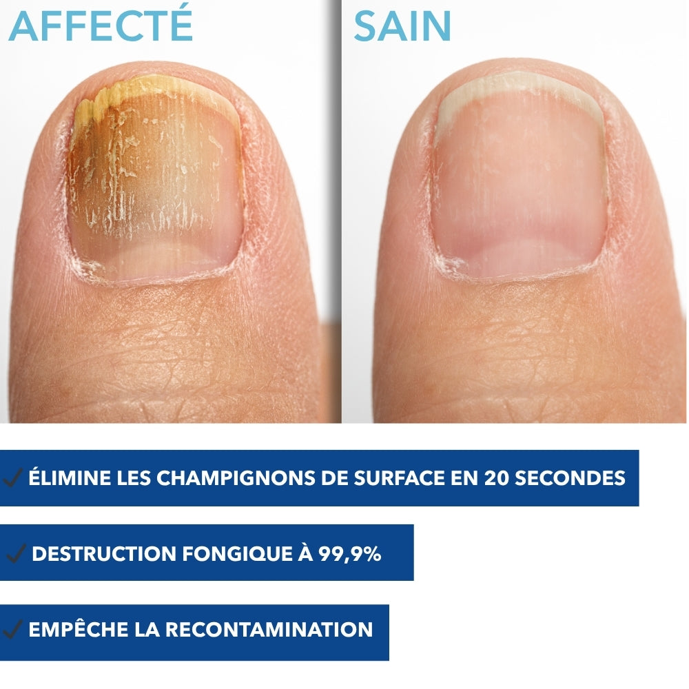 addax-mycoflash-pro-stylo-traitement-mycoses-ongles image 2